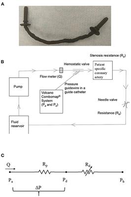 Improved Functional Assessment of Ischemic Severity Using 3D Printed Models